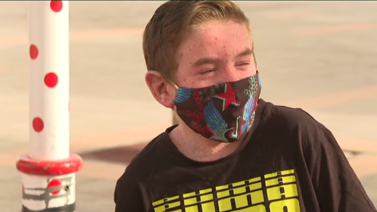 Guise, un niño majorero con una enfermedad rara en la piel