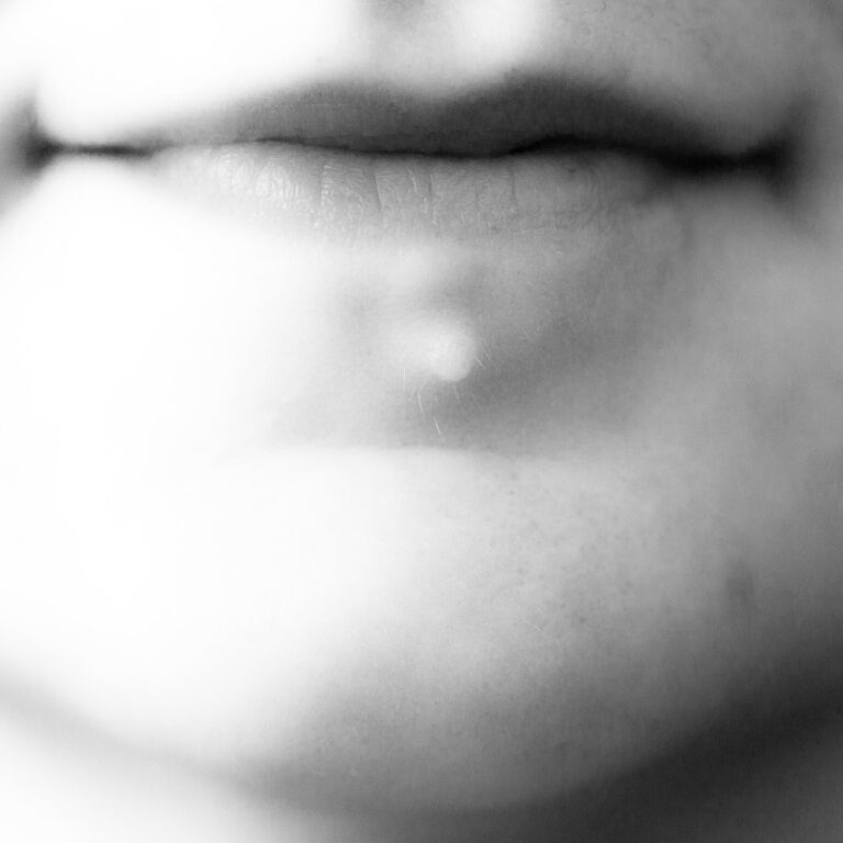 ‘La piel tiene sus razones’