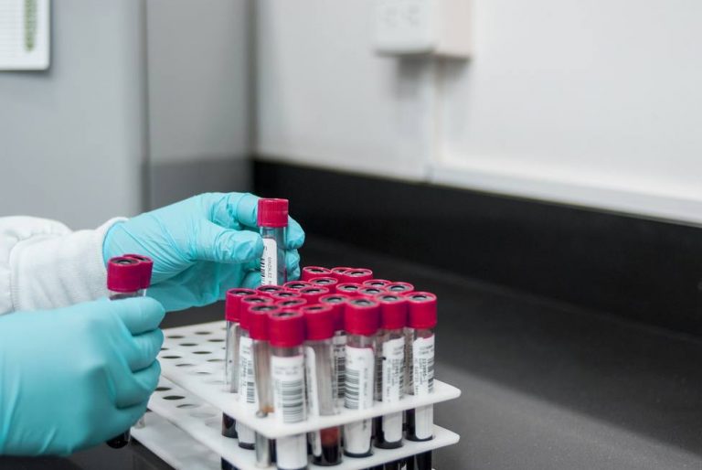 Más de 3.000 personas al año son diagnosticadas de VIH en España