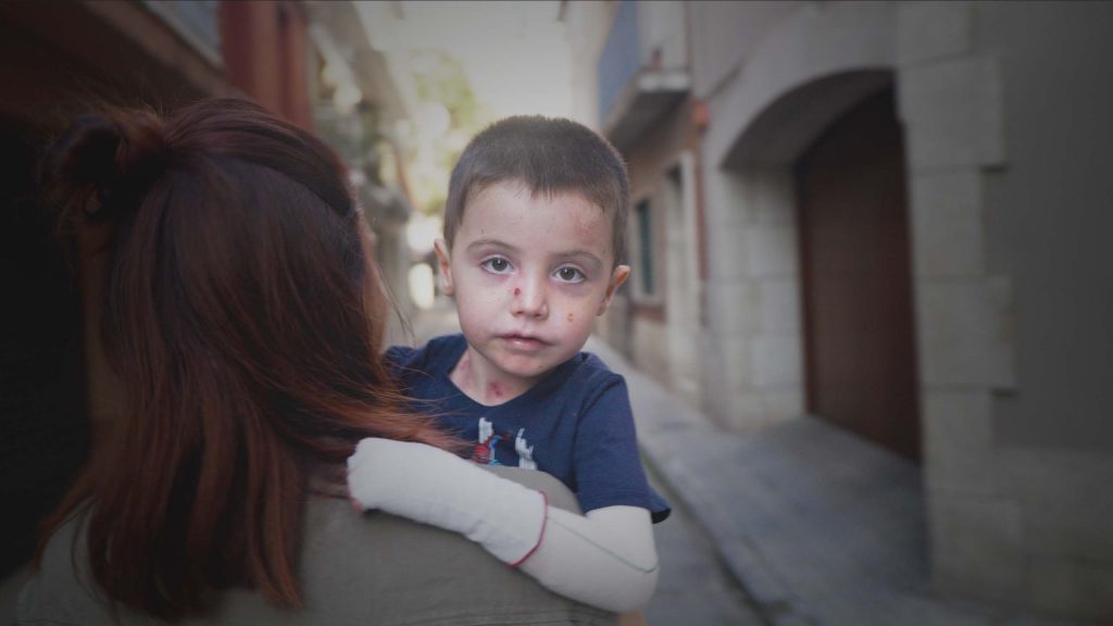 La ONG DEBRA Piel de Mariposa lanza la campaña ‘Ponte en su Piel’