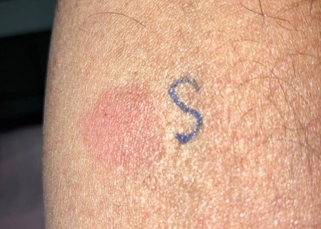 Crean un test rápido que señala si es necesaria una dosis adicional de la vacuna 