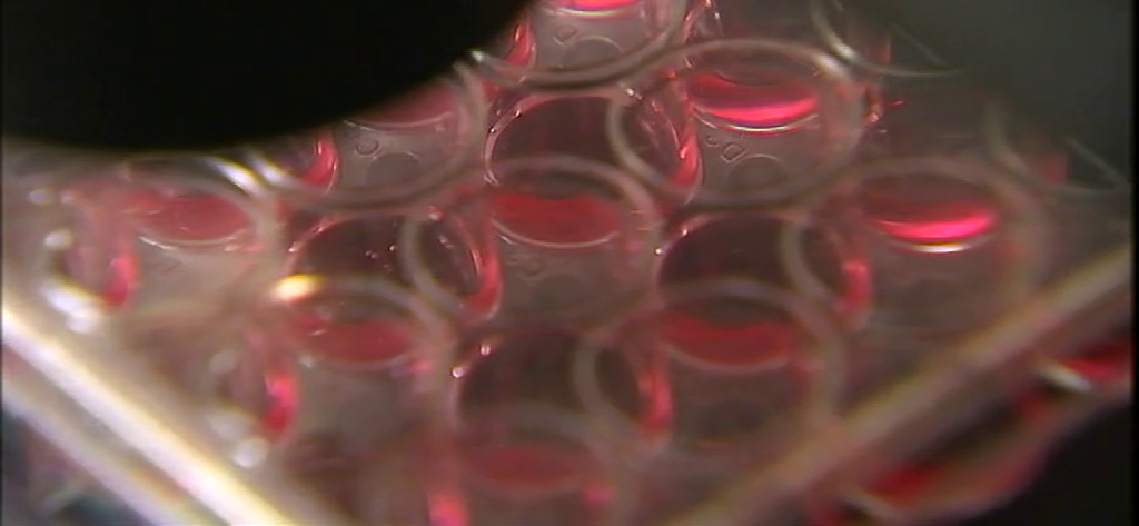 Una mujer se cura del VIH por primera vez en la historia