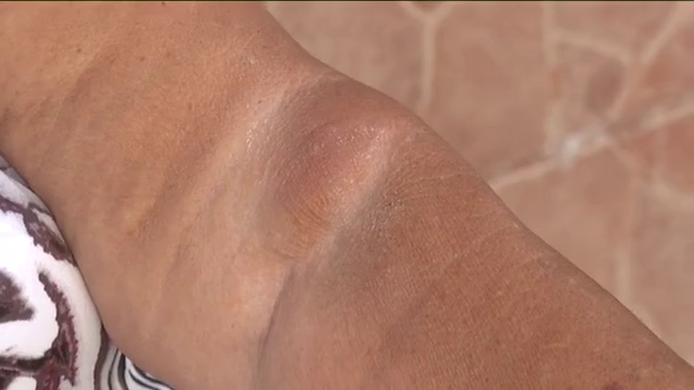 Los vecinos de La Lajita piden una solución frente a los mosquitos