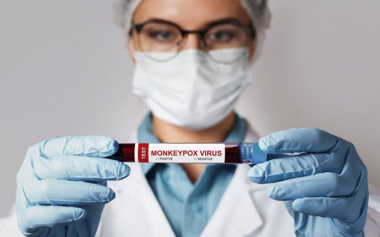 Cuba confirma la muerte de un ciudadano italiano por viruela símica