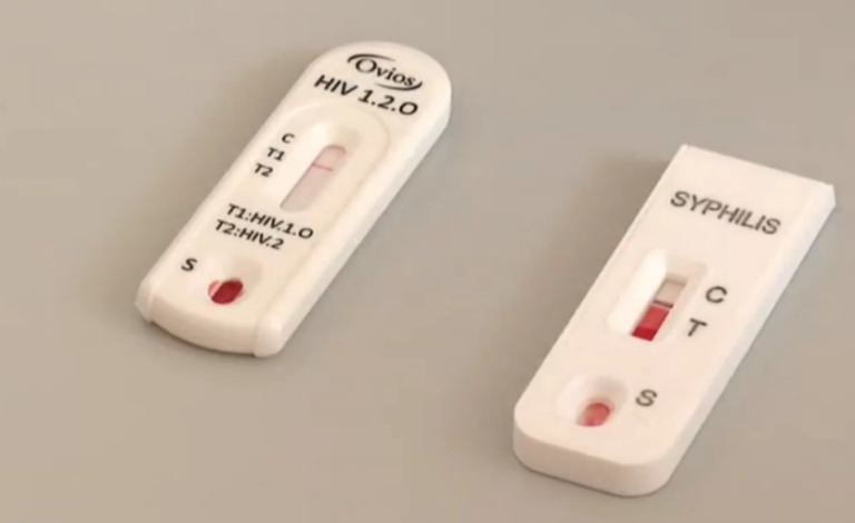 Detectan en Canarias 242 nuevas infecciones por VIH en 2024