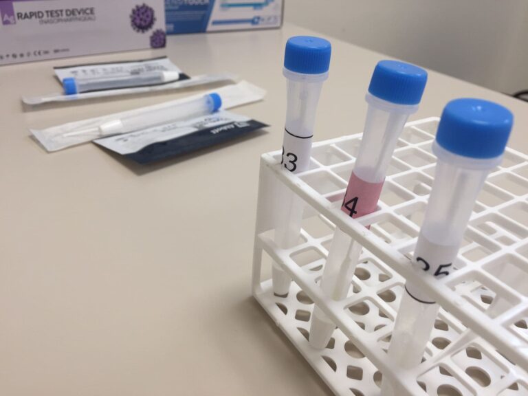 Las islas se mantienen en nivel de riesgo sanitario bajo por COVID-19