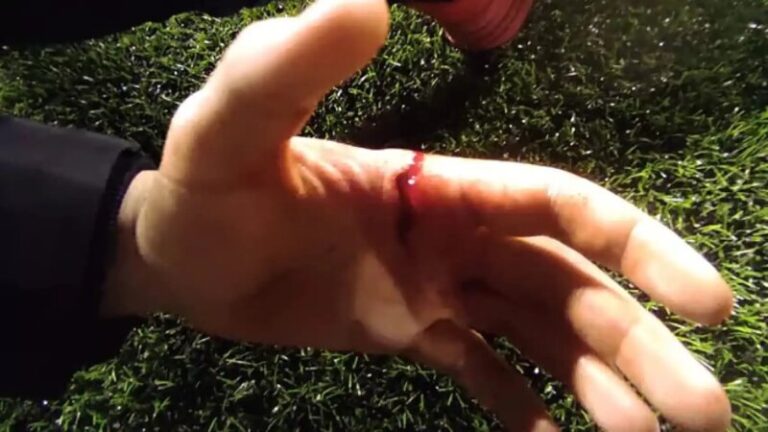 Queda en libertad uno de los detenidos por la pelea en el partido entre el Unión Pedro Hidalgo B y el CD Firgas