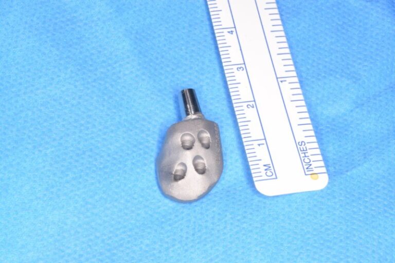 Cirujanos del HUC desarrollan junto al ITC una miniprótesis de mandíbula menos invasiva