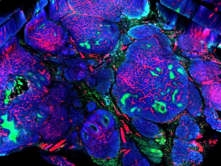 Identifican la capacidad antitumoral de un pigmento frente al cáncer de mama