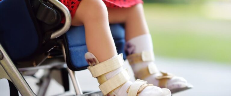 El Cabildo de Gran Canaria fomenta prácticas en personas con parálisis cerebral