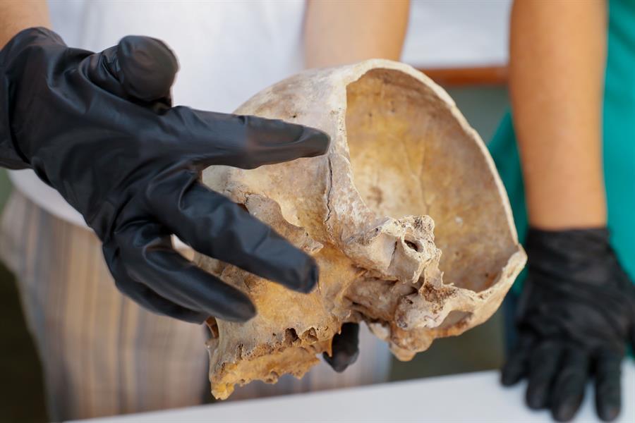 La revisión de los fondos del Museo Canario ha aportado una prueba directa de que las primeras sociedades que habitaron Canarias no estuvieron tan aisladas del exterior durante siglos como se pensaba: una herida de espada, un arma ajena por completo al mundo aborigen, que le seccionó la cabeza a un varón entre 200 y 300 años antes de la llegada de los europeos. La conservadora del Museo, Teresa Delgado, muestra el cráneo, datado entre los siglos XI y XII, con la herida de espada. EFE/Elvira Urquijo Á.