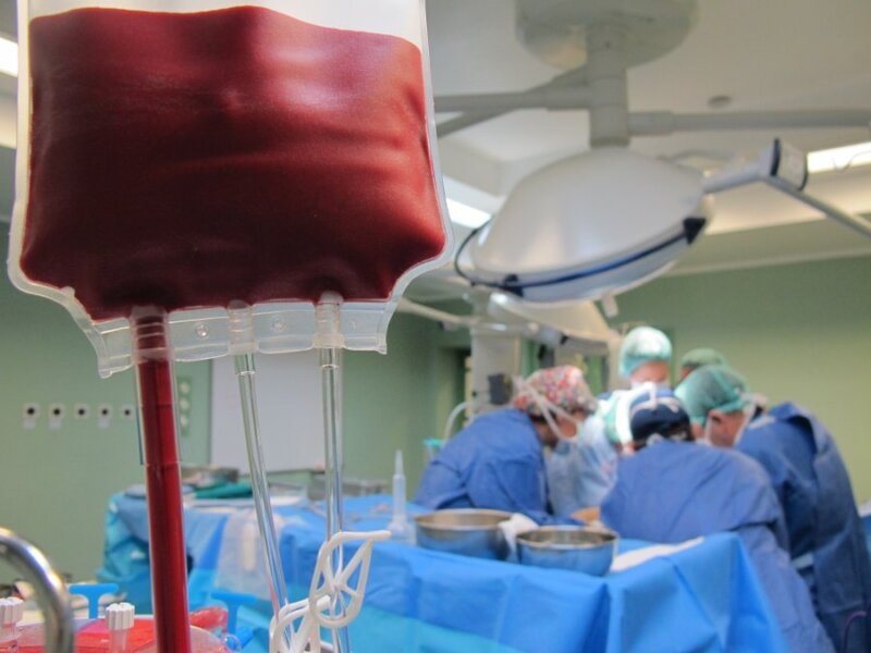 Imagen de recurso trasplante de pulmón. 