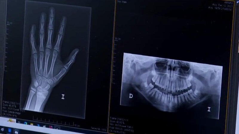 La edad de los migrantes determina su destino