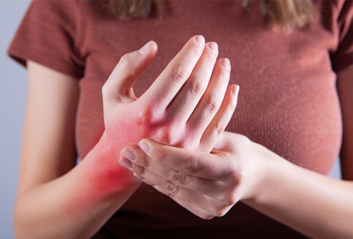 El lupus es una enfermedad autoinmunitaria crónica, el propio sistema inmunitario ataca y daña a las células