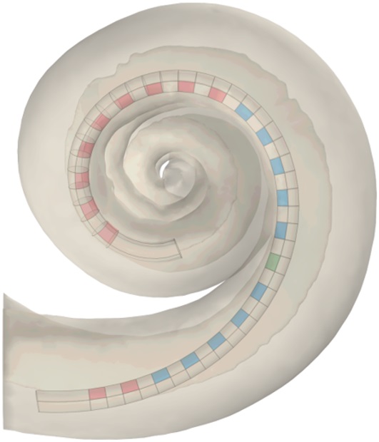 La ULPGC desarrolla un modelo para mejorar la audición en pacientes con implantes cocleares