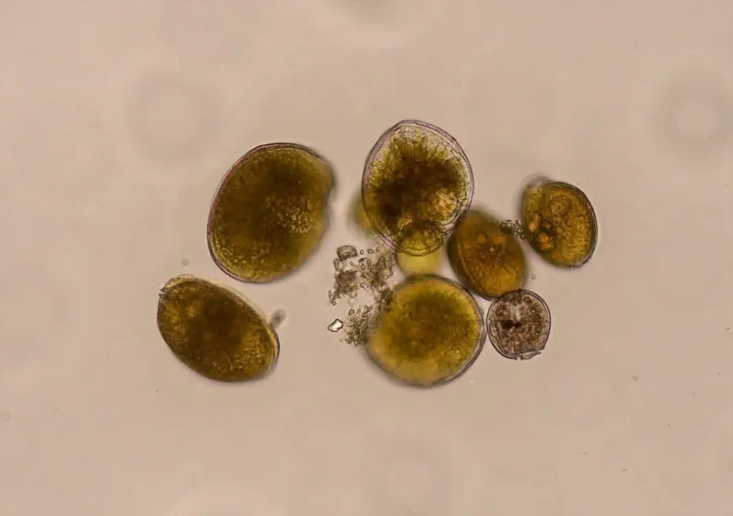 Confirman por primera vez la presencia del género 'Gambierdiscus' en la costa peninsular española, una microalga asociada a la ciguatera