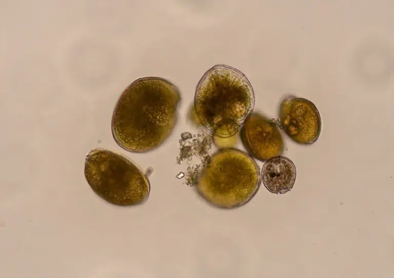 Investigadores de la ULPGC detectan en el Mediterráneo la microalga productora de toxinas en los peces