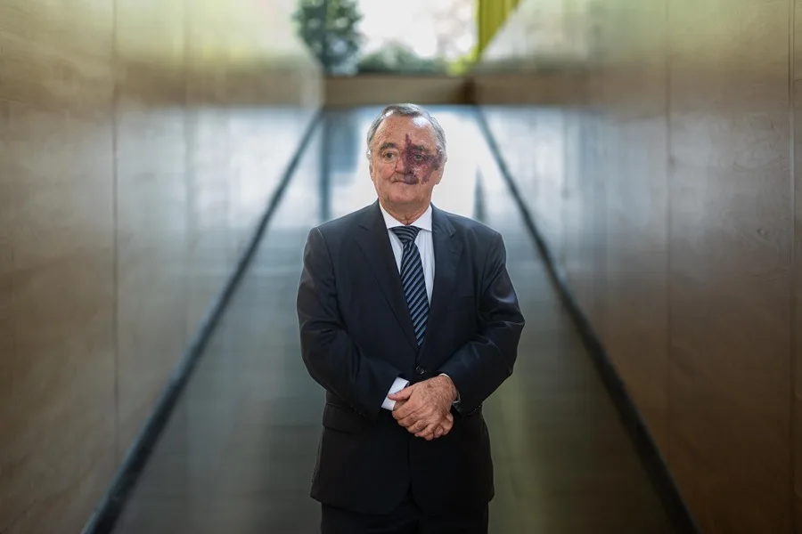 El cáncer colorrectal será el tumor más diagnosticado en 2026