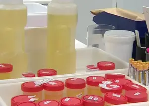 Sanidad refuerza la prevención ante el repunte de infecciones de transmisión sexual en Carnaval