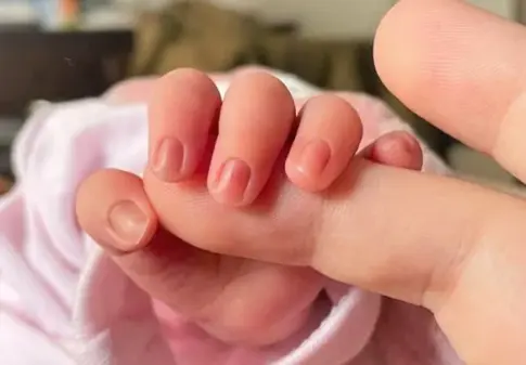 Nueve bebés afectados en Canarias por leches contaminadas con toxina cereulida, ninguno grave