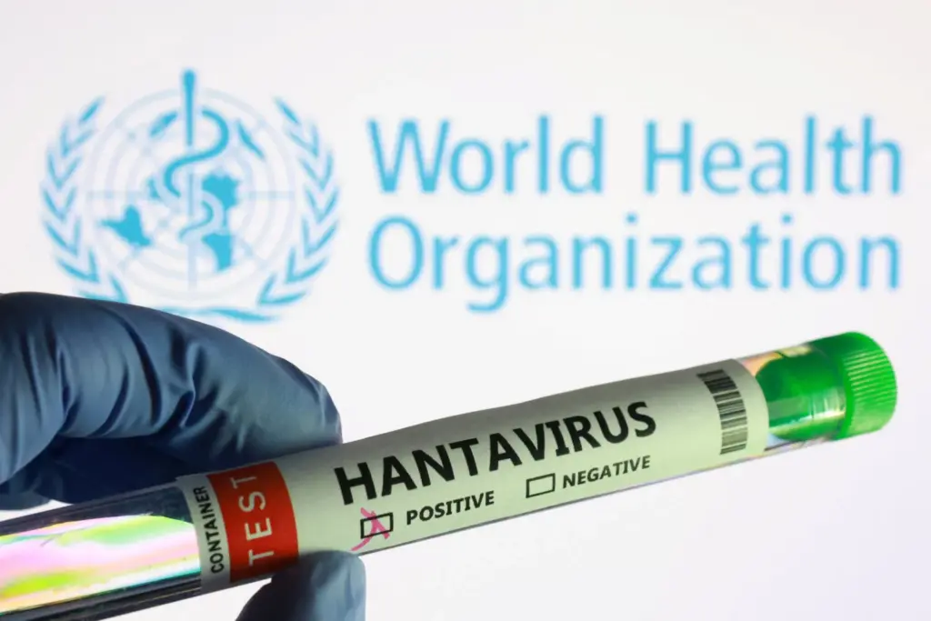 Tubo de analítica de hantavirus. Imagen de recurso Reuters