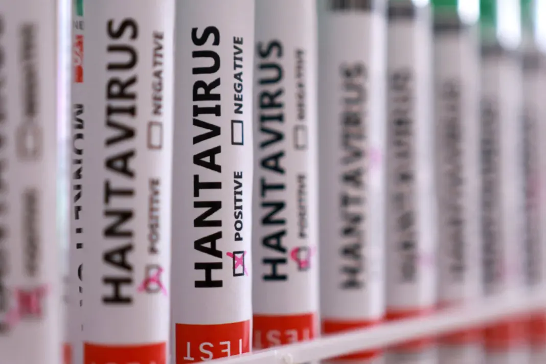Muestra de tubos de ensayo de hantavirus