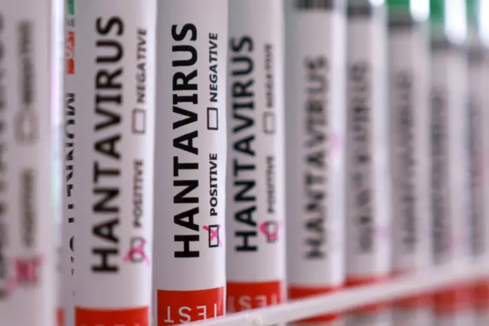 Muestra de tubos de ensayo de hantavirus