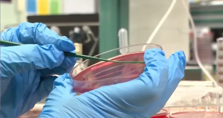 El Hospital La Candelaria crea un test rápido contra bacterias multirresistentes